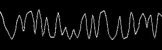 Normal speed