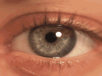 Radial Transition